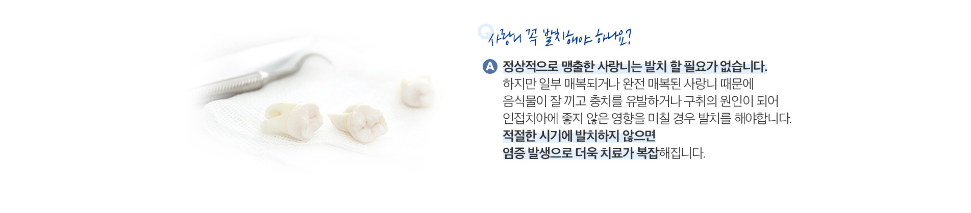사랑니발치 (Wisdom Tooth Extraction)
